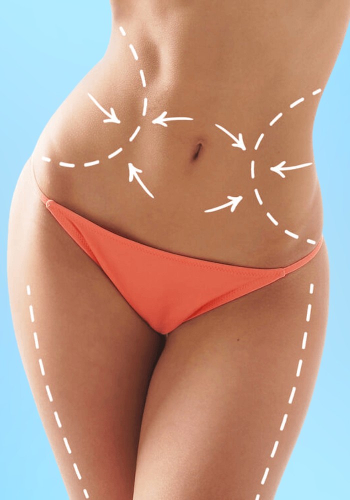 Lipo360
