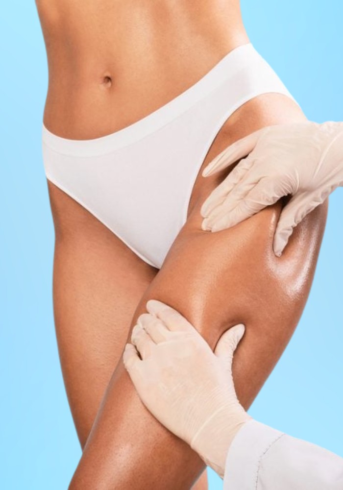 Thigh Liposuction