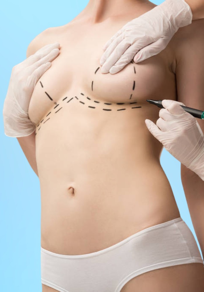 Breast Lift